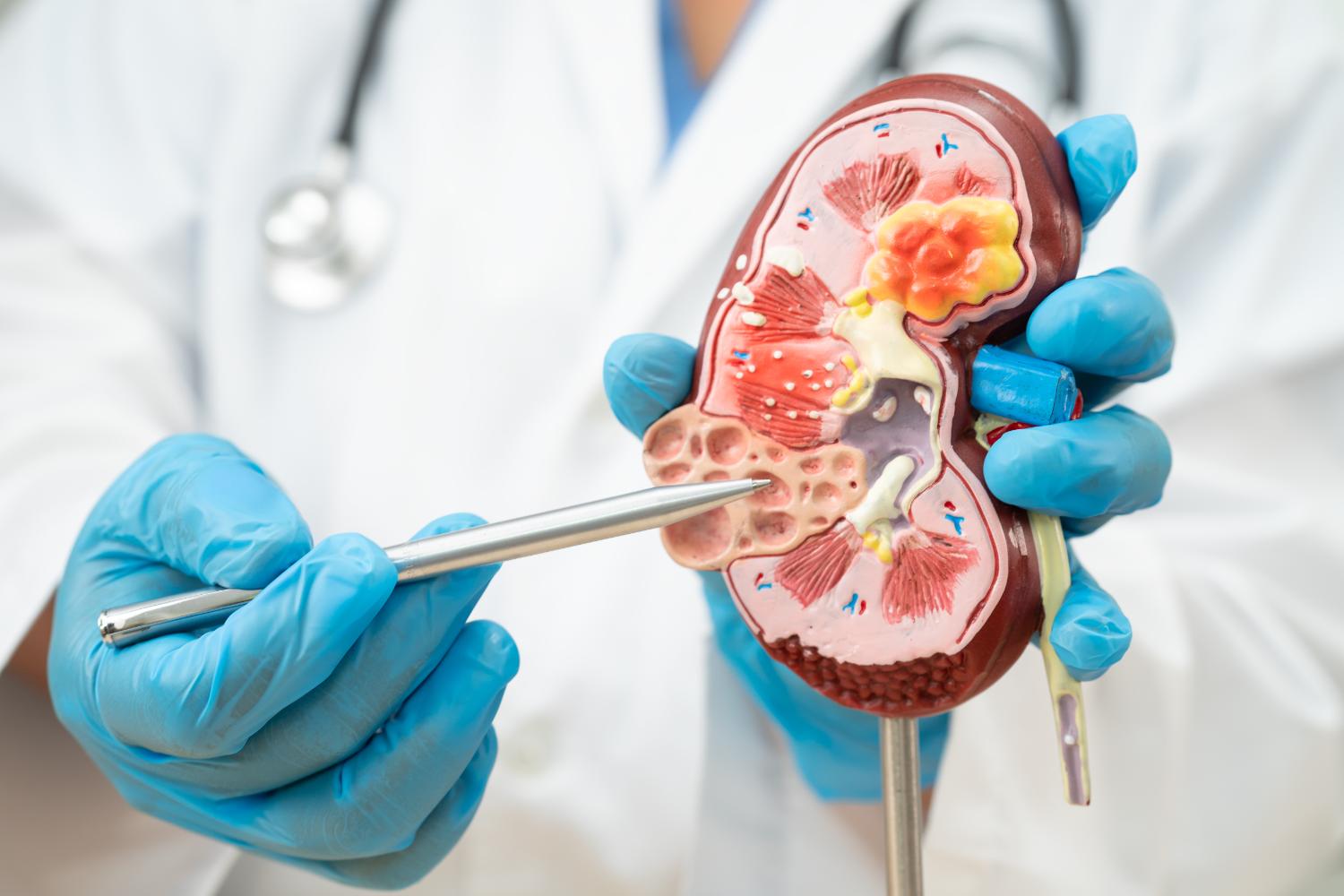 Marzo: prendersi cura dei reni, un gesto semplice di prevenzione